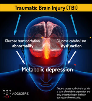 Human brain illustrated with millions of small nerves TBI